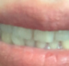 狮王（Lion）齿力佳酵素白牙膏绿野柠檬120g护龈新老包装随机发货檀健次同款 实拍图