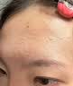 维特丝壬二酸15%凝胶祛痘膏祛痘印淡痘印水杨酸胶态硫烟酰胺乳青春期 实拍图