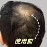 DELIISTON英国生姜防脱洗发水防脱发固发养发非增发密发育控油蓬松老姜王 【一瓶防脱、三瓶增发】正品有防伪 无效全额退 实拍图