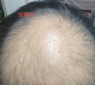 蔓迪【二代米诺地尔】蔓迪5%生发泡沫60g*2（敏皮专属 温和不油腻）男女士快速防脱育发米洛原液搽剂酊曼迪 实拍图