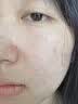 维特丝洗面奶男女士氨基酸美白淡斑提亮肤色控油收缩毛孔深层清洁黑头角 实拍图