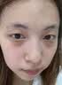 山本星奈眼霜淡化细纹提拉紧致黑眼圈重度去除祛男女士熬夜黑色素专用的药 单盒装【快速去黑眼圈】 实拍图
