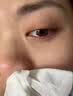 岩井昃弘日本原装非进口鼻炎喷剂鼻喷雾剂专用中药断治i根过敏性鼻窦炎 买3送2【重度鼻窦炎】特效喷剂 苍耳子鼻通喷剂穴位贴专用膏 实拍图
