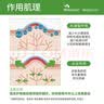 美皮护疤痕贴硅酮祛疤瑞典【双眼皮】2.5X10cm【全网低价】祛疤贴 实拍图
