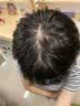 维特丝防脱洗发水生姜固发侧柏叶育控油去屑持久蓬松洗头膏露男女士专用 实拍图