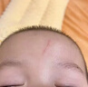 沃朗森祛疤膏去疤痕专用修复儿童医院硅酮凝胶医用手术缝针除疤药膏 1盒 实拍图
