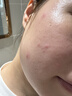 薇诺娜第二代特护面膜24片套装退红修护舒缓补水保湿七夕礼物 实拍图
