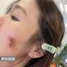 PENGRDOCTOR祛疤膏儿童去祛疤痕专用修复医用硅酮除疤生长因子凝胶膏剖腹产贴 实拍图