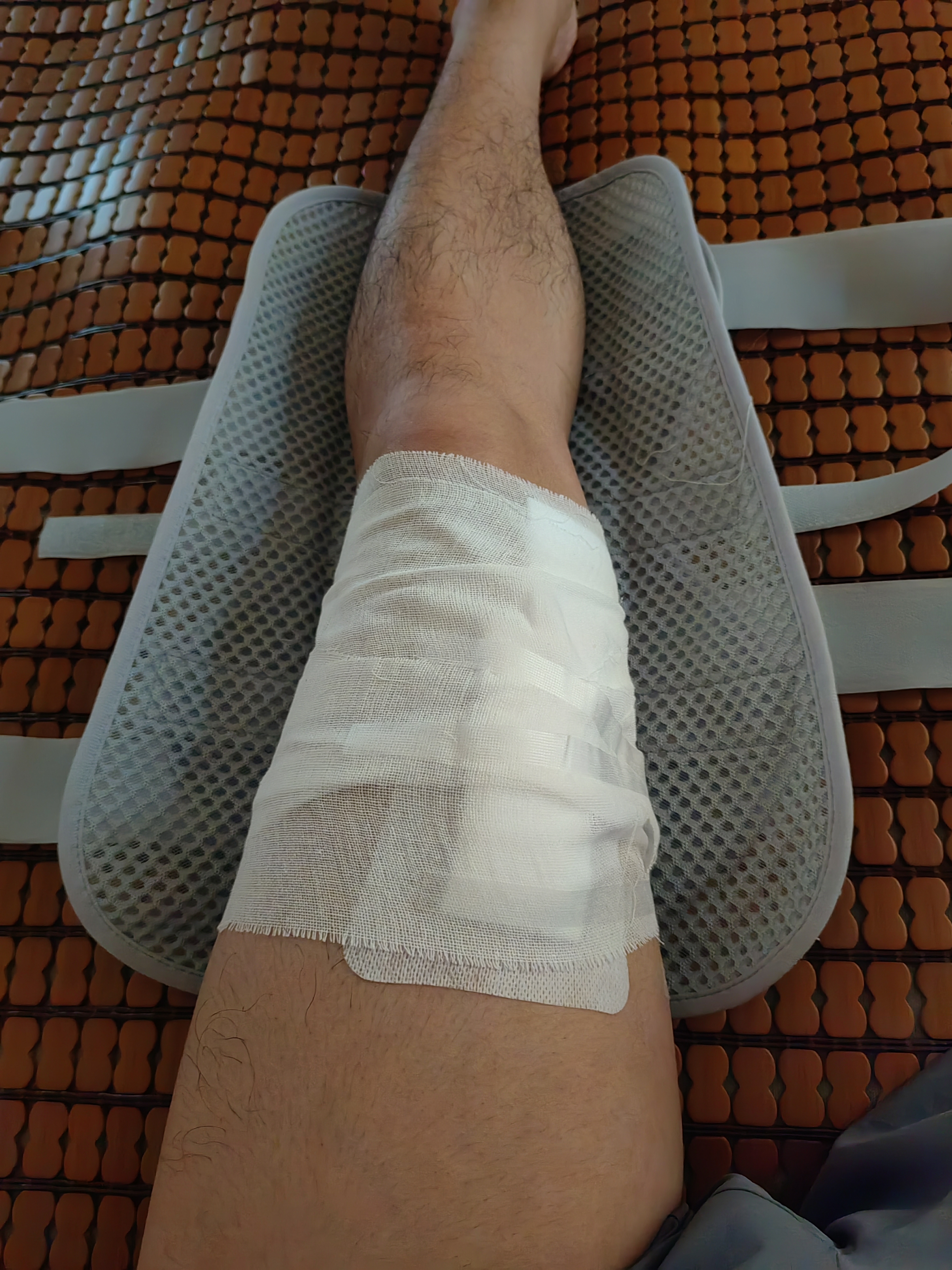 冠爱（GUANAI）医用膝关节固定支具膝盖骨折韧带损伤下肢半月板护膝髌骨护具透气 实拍图