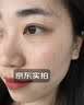 川廿制药熊果苷乳膏精华液去斑黑色素医用脸部改善暗沉男女士搭烟酰胺凝胶 实拍图