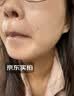 川廿制药去痣点痣膏无痕点斑点疣药水脸部不留疤美容院专用祛黑痣肉痣 实拍图