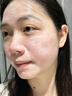 维特丝B5滋润补水保湿面霜男女士护肤品敏感肌屏障舒缓泛红干燥紧肌肤 【敏感肌优选】B5保湿补水面霜100g 实拍图