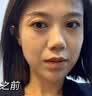 Newliann30支医用重组胶原蛋白次抛精华液抗皱紧致淡斑补水修复皮肤屏障 实拍图