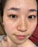 EDRI氨甲环酸祛斑乳膏医美用祛斑霜美白淡化黑色素黄褐斑雀斑晒斑男女 实拍图