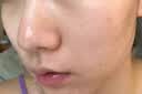 白云山去黑头撕拉面膜壬二酸清洁泥膜水杨酸鼻膜收缩毛孔深层清洁男士女 实拍图