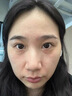 维特丝377面霜乳液男女士美白祛斑紧致高保湿补水去黄提亮黑色素护肤品 实拍图