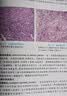 口腔医学本科教材 全套17册第八版人卫配口腔解剖生理学黏膜病修复种植牙周牙体牙髓颌面外科组织病理修复正畸学民卫生出版社医学教材 口腔解剖生理学 第8版 晒单实拍图