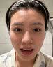 BUV蔡徐坤青少年洗面奶祛痘控油学生专用氨基酸去黑头痘印100g七夕 实拍图