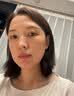 澳白汀（OHBT）氨甲环酸精华液传明酸湿敷原液医美祛斑改善暗沉黄褐斑专用50ml 实拍图