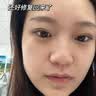 透真维生素b5修复精华液补水保湿术后皮肤屏障受损泛红角质层修护敏肌 实拍图