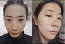 OHBT面膜美白淡斑补水保湿男女士熬夜舒缓抗皱紧致去黄气暗沉提亮肤色 实拍图