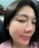 OHBT壬二酸15%凝胶水杨酸祛痘药膏祛痘淡化痘印坑消炎痤疮专用青少年 实拍图