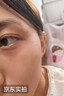 BKWILD美国进口硅酮去疤痕药膏祛疤膏疤痕修复除疤硅酮凝胶医用儿童 实拍图
