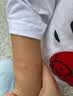 高坂制药蚊虫叮咬止痒消肿滚珠驱防蚊神器成人母婴幼儿童抑菌皮肤瘙痒红肿 实拍图