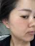 维特丝377面霜乳液男女士美白祛斑紧致高保湿补水去黄提亮黑色素护肤品 实拍图