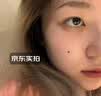 川廿制药去痣点痣膏无痕点斑点疣药水脸部不留疤美容院专用祛黑痣肉痣 实拍图