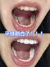 馥诺诗牙膏美白去黄去口臭亮白牙渍去烟渍除臭清新口气抑菌成年人150g 实拍图