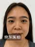 川廿制药烟酰胺凝胶精华液祛斑美白淡化黑色素医用男女士专用搭熊果苷乳膏 实拍图
