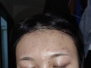 维特丝壬二酸15%凝胶祛痘膏祛痘印淡痘印水杨酸胶态硫烟酰胺乳青春期 实拍图