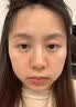 OHBT胶原蛋白面膜抗皱紧致抗衰老补水美淡白斑去黄气暗沉提亮肤色男女 实拍图