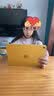 Apple/苹果 iPad 11英寸 A16芯片2025年款 平板电脑 (128GB WLAN版/学习办公娱乐)黄色 实拍图