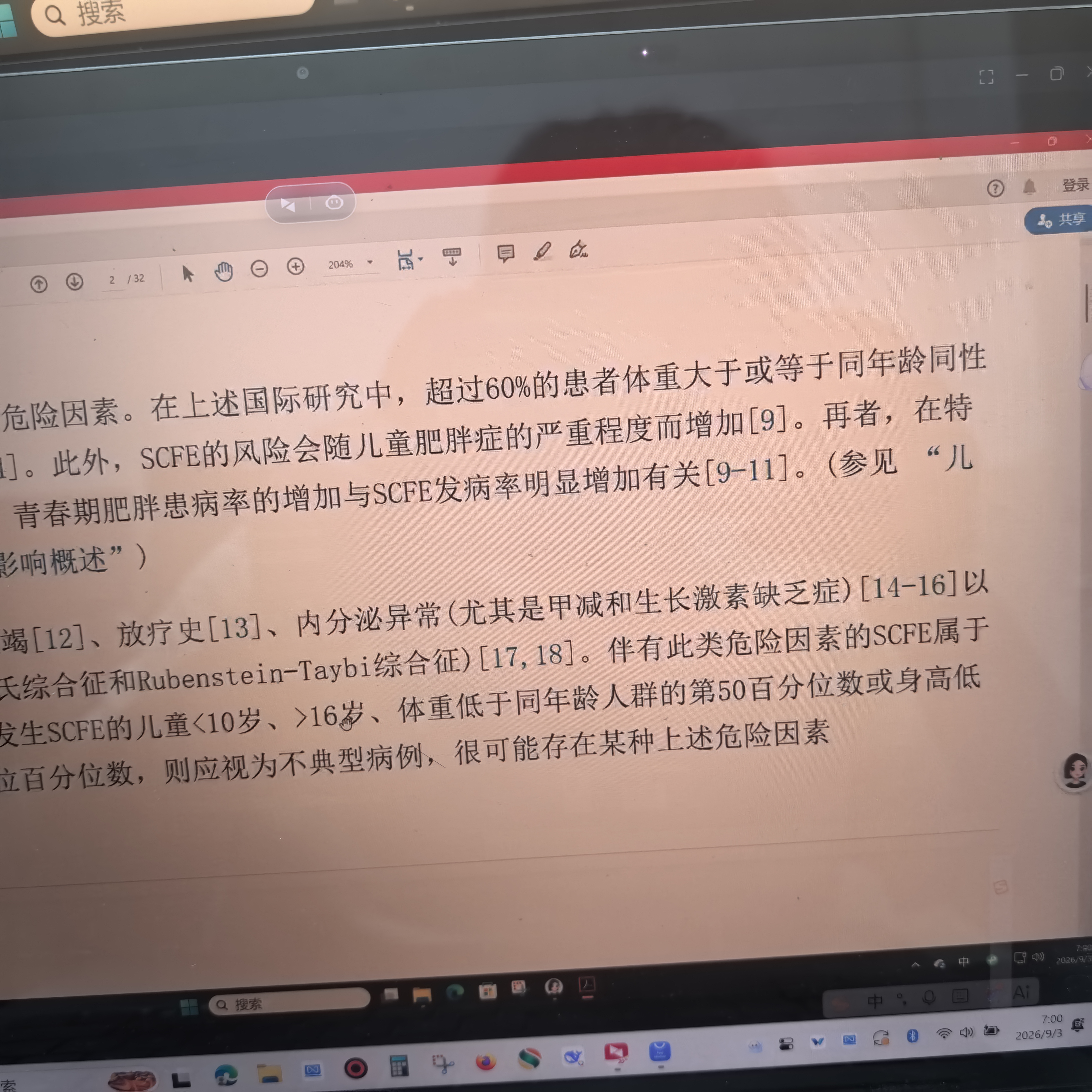 贝锐向日葵IPKVM远程控制手机Q1远控手机无网内网电脑桌面办公overip工业医疗机房运维bios监测监控SSH服务器 向日葵Q1：无网远控IPKVM 向日葵控控Q1 实拍图