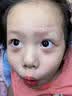 诗丽莎硅酮疤痕凝胶祛疤膏修护儿童成人创伤烧烫剖腹产增生凸起手术 ３盒装【买2送同款1支】活性修护-适用任何疤痕 实拍图