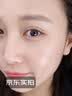 淞町制药去痣点痣膏专用脸面部不留疤祛痣膏点斑克跖疣药水正品无痛无疤痕 实拍图