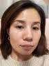 维特丝377面霜乳液男女士美白祛斑紧致高保湿补水去黄提亮黑色素护肤品 实拍图