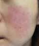 华美科医用小分子补水保湿喷雾妆前敏感肌抗皱紧致爽肤生长修复因子1瓶 实拍图