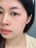 华美科医用重组人体表皮生长因子点痣疤痕修复凝胶烫软膏伤口愈合15g1支 实拍图