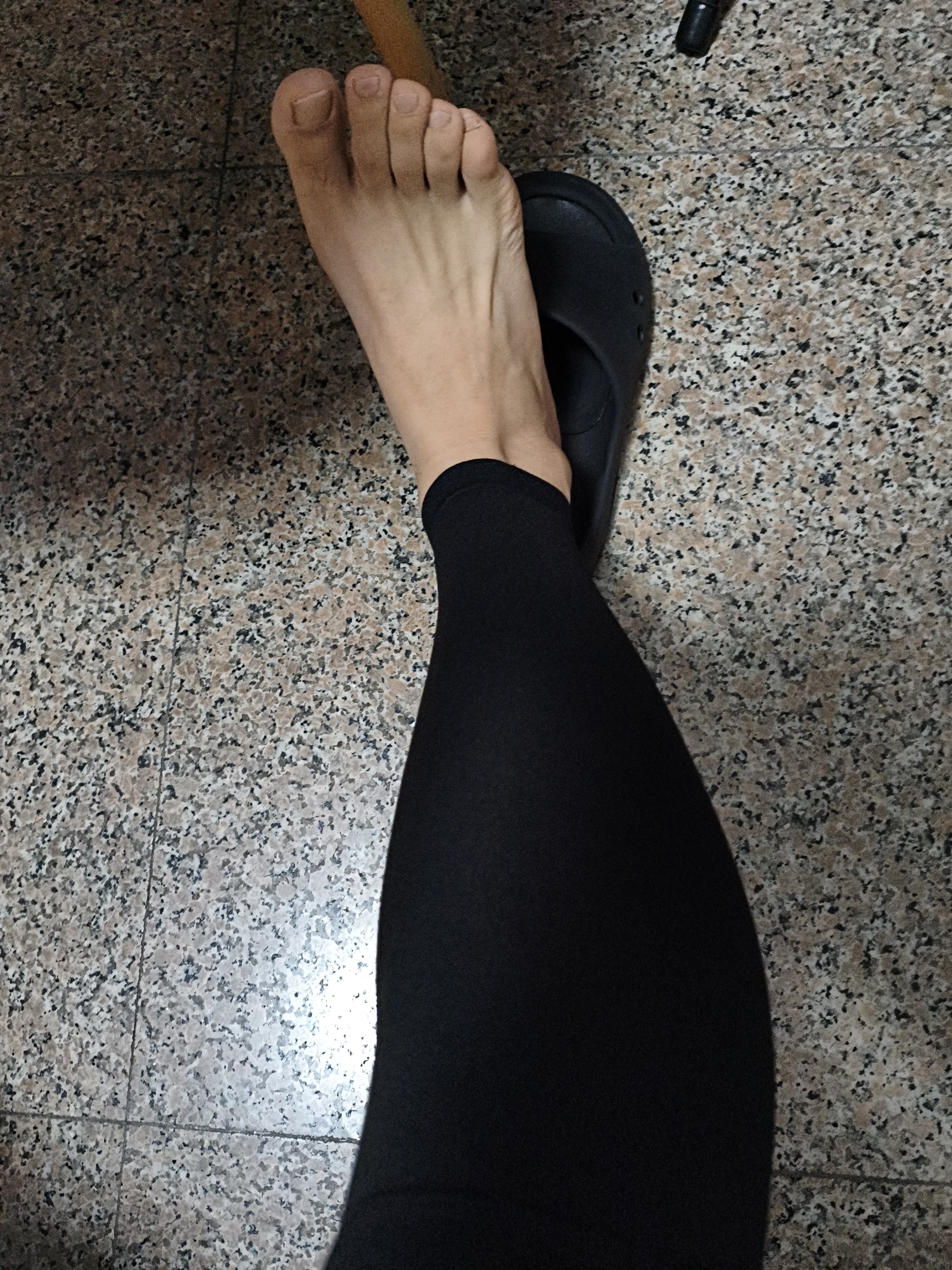 KDANG医用级静脉曲张弹力袜压力袜防静脉血栓治疗型男女一级术后恢复 实拍图