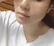 [祺笑]化瘀祛斑胶囊 0.32g*50粒 3盒装 祛斑专用祛黑色素黄褐斑内调口服满脸黄褐斑雀斑老年斑日晒斑医用级水药男女士 98%祛斑顾客选择 实拍图