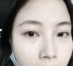 久卜制药烟酰胺i凝胶美白祛斑芦荟胶修复皮肤搭熊果苷淡化黑色素 3盒 实拍图