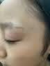 诗丽莎硅酮疤痕凝胶祛疤膏修护儿童成人创伤烧烫剖腹产增生凸起手术 ３盒装【买2送同款1支】活性修护-适用任何疤痕 实拍图