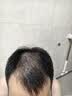 蔓迪【二代米诺地尔】蔓迪5%生发泡沫剂60g*3（倍速温和生发）男女专用治脱发防脱洗发水育发米洛酊搽剂 实拍图