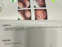 奈立制药日本液体止鼾器打鼾打呼噜重度止鼾神器喷雾舒鼻炎通气防鼻子堵塞 实拍图
