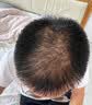 DR.SOKK生发液激活毛囊增发密发长发剂育发液固发液防脱发严重男女士专用 实拍图