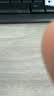 丽芙阿达帕林凝胶0.1%*16g/盒第三代维a酸乳膏祛痘印改善毛孔粗大医用正品祛痘痤疮专用青少年修复去黑头药膏 实拍图