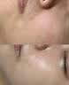 奈皙377美白祛斑霜正品去黄褐斑雀斑晒斑女士用的效果最好的产品护肤 实拍图